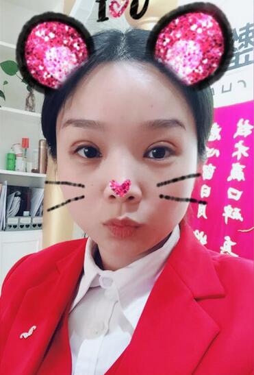 全切雙眼皮1個月過程圖