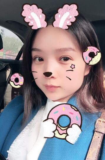 全切雙眼皮1個月過程圖