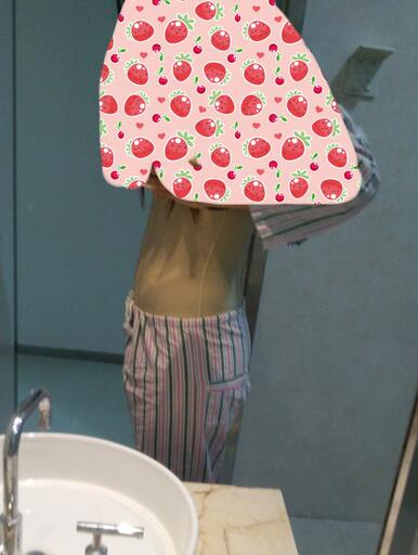 腰腹抽脂3個月的感受