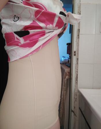 腰腹抽脂3個月的感受