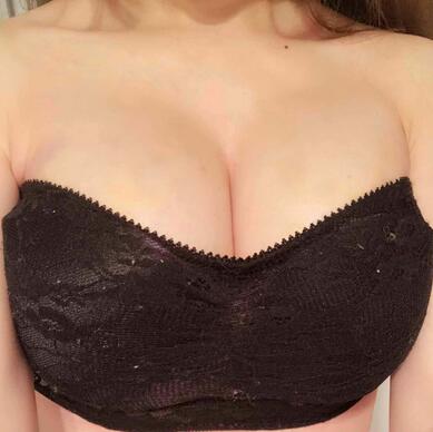 自體脂肪豐胸之后多久能上班 北京麗星豐胸恢復(fù)紀實