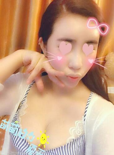 自體脂肪豐胸之后多久能上班 北京麗星豐胸恢復(fù)紀實