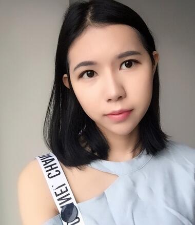 自體脂肪填充恢復(fù)日志 自體脂肪填充太陽穴+額頭