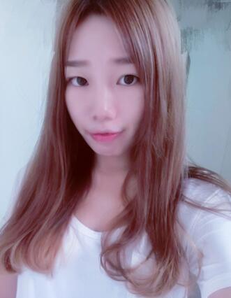 硅膠隆鼻恢復(fù)日記 硅膠隆鼻+鼻小柱延長+墊鼻尖