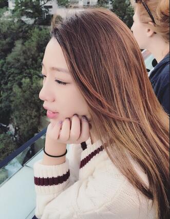 硅膠隆鼻恢復(fù)日記 硅膠隆鼻+鼻小柱延長+墊鼻尖