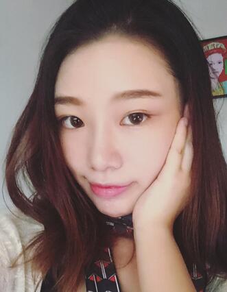 硅膠隆鼻恢復(fù)日記 硅膠隆鼻+鼻小柱延長+墊鼻尖