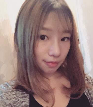 硅膠隆鼻恢復(fù)日記 硅膠隆鼻+鼻小柱延長+墊鼻尖