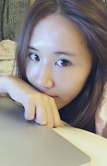 面部脂肪填充后圖片 自體脂肪面部填充恢復(fù)記錄