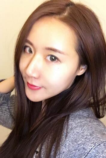 面部脂肪填充后圖片 自體脂肪面部填充恢復(fù)記錄