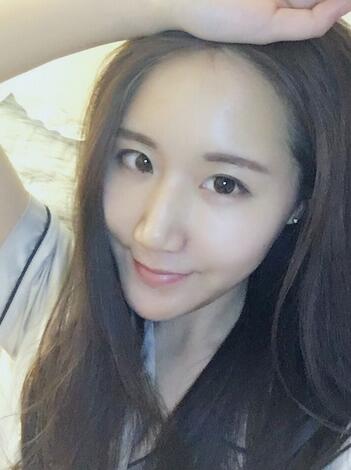 面部脂肪填充后圖片 自體脂肪面部填充恢復(fù)記錄