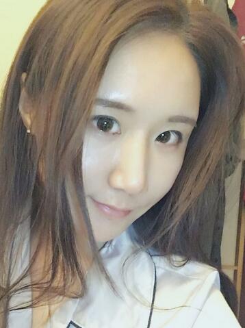 面部脂肪填充后圖片 自體脂肪面部填充恢復(fù)記錄