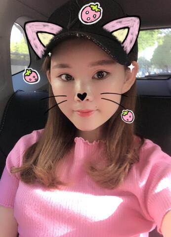 詳細(xì)部脂肪填充果圖 術(shù)后恢復(fù)分享