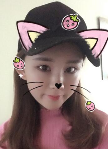 詳細(xì)部脂肪填充果圖 術(shù)后恢復(fù)分享