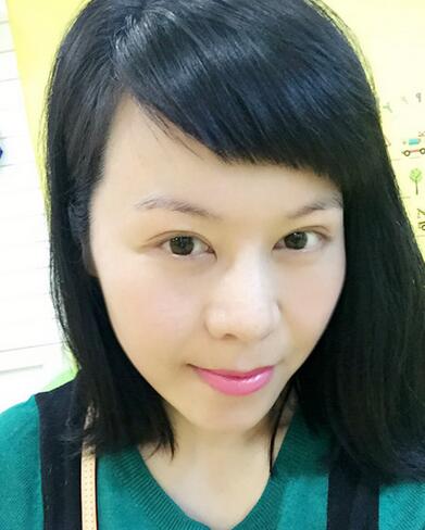 面部埋埋蛋白線.提升恢復(fù)過(guò)程分享