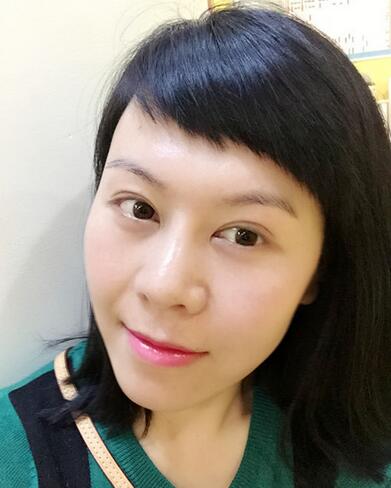 面部埋埋蛋白線.提升恢復(fù)過(guò)程分享