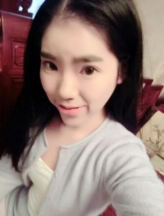 隆鼻整形2個(gè)月恢復(fù)日記 硅膠隆鼻+鼻翼縮小