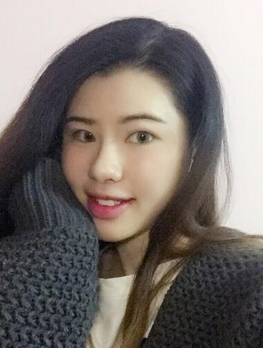 切開重瞼術(shù)恢復過程圖