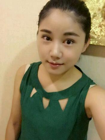 全切雙眼皮半年恢復(fù)過程圖