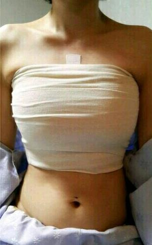 假體隆胸圓形躺下果圖