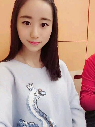 割雙眼皮案例圖片 雙眼皮手術(shù)20天