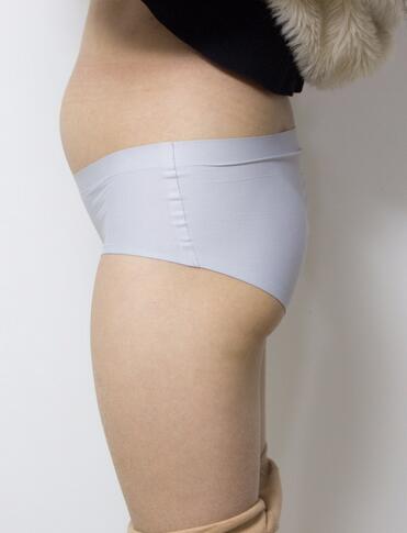 廣州威利斯腰腹吸脂