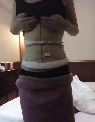 廣州威利斯腰腹吸脂