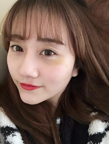 上海潔銘線D提升三個(gè)月后的圖片