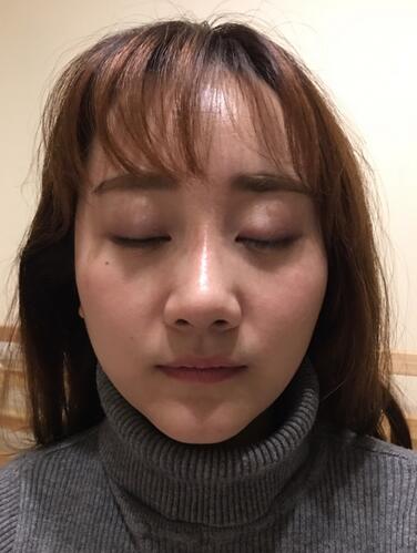 上海潔銘線D提升三個(gè)月后的圖片