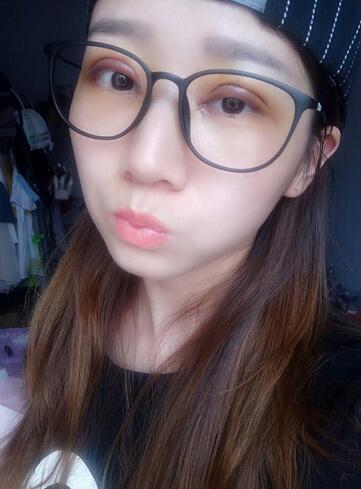 上海九院林曉曦割雙眼皮半年了