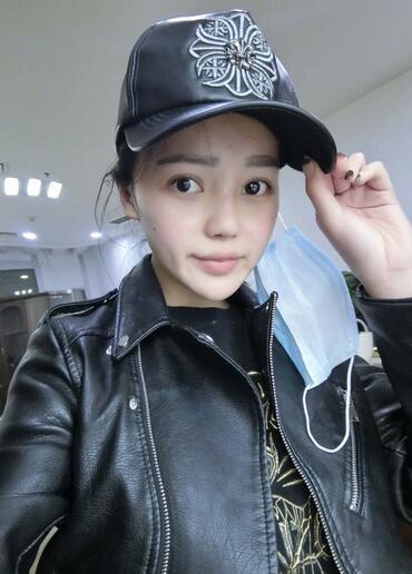 上海九院李圣利隆鼻整形真實(shí)恢復(fù)期圖片