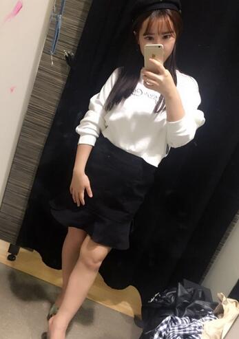 上海九院曹衛(wèi)剛大腿抽脂后恢復(fù)圖