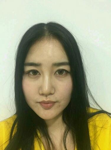 北京八大處范飛隆鼻整形案例