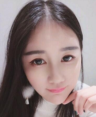 北京八大處范飛隆鼻整形案例