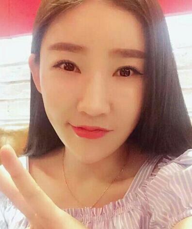 武漢西嬋康美假體隆鼻+眼部綜合整形