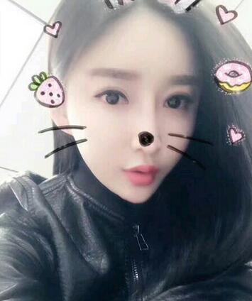 武漢西嬋康美假體隆鼻+眼部綜合整形