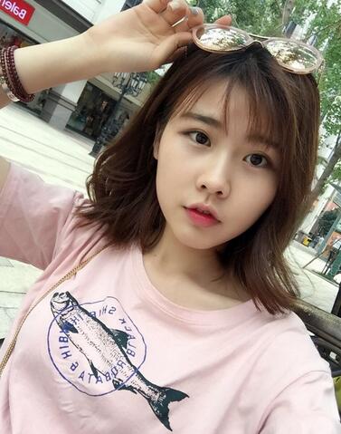 武漢西嬋康美玻尿酸隆鼻恢復(fù)過程圖