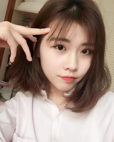 武漢西嬋康美玻尿酸隆鼻恢復(fù)過程圖