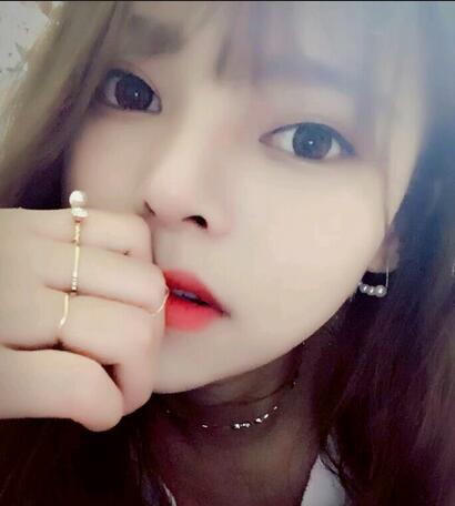 隆鼻整形真實(shí)恢復(fù)期圖片 杭州東方隆鼻整形四個(gè)月