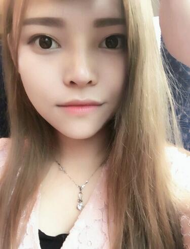 隆鼻整形真實(shí)恢復(fù)期圖片 杭州東方隆鼻整形四個(gè)月