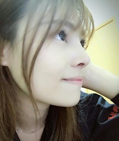 隆鼻整形真實(shí)恢復(fù)期圖片 杭州東方隆鼻整形四個(gè)月