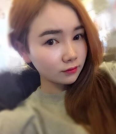 八大處楊明勇做的雙眼皮 半年了