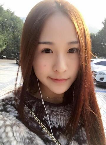 杭州大麥微針龍都整形開(kāi)眼角+割雙眼皮恢復(fù)記錄