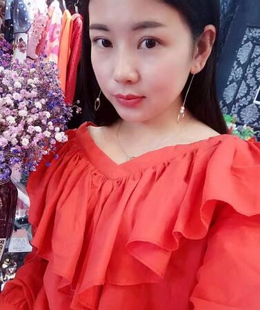 北京八大處辛敏強(qiáng)做雙眼皮怎么樣 案例分享