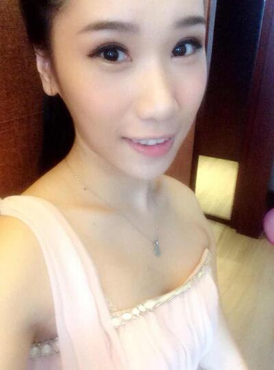 自體脂肪隆胸一個月后 北京葉子做的