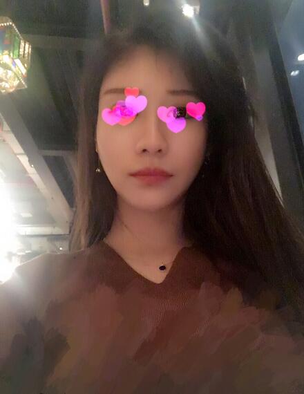 北京葉子磨下頜角整形的果圖