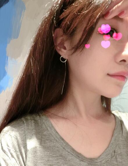 北京葉子磨下頜角整形的果圖