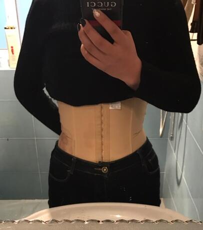 腹部吸脂兩個(gè)月親身經(jīng)歷 深圳仁安雅吸脂案例