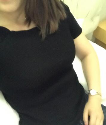 腹部吸脂兩個(gè)月親身經(jīng)歷 深圳仁安雅吸脂案例