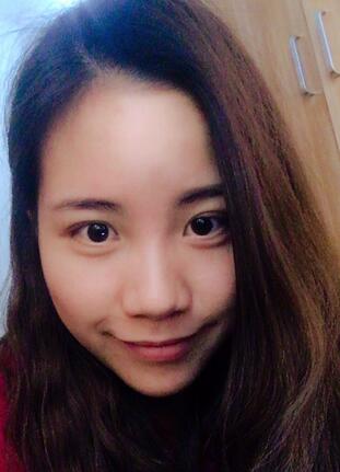 北京藝星王英勇隆鼻案例 隆鼻整形三個(gè)月