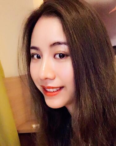 北京藝星王英勇隆鼻案例 隆鼻整形三個(gè)月